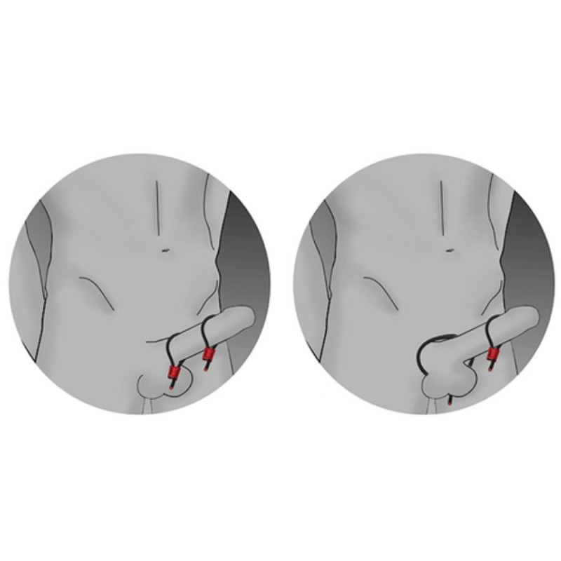 ELECTRASTIM PRESTIGE ELECTRA LOOPS ANILLOS DE PENE AJUSTABLES ROJO