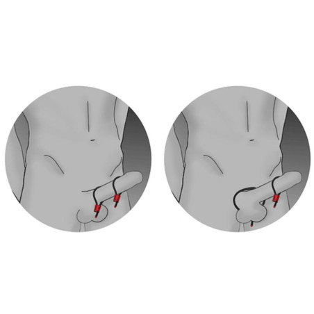 ELECTRASTIM PRESTIGE ELECTRA LOOPS ANILLOS DE PENE AJUSTABLES ROJO