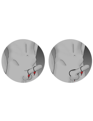 ELECTRASTIM PRESTIGE ELECTRA LOOPS ANILLOS DE PENE AJUSTABLES ROJO