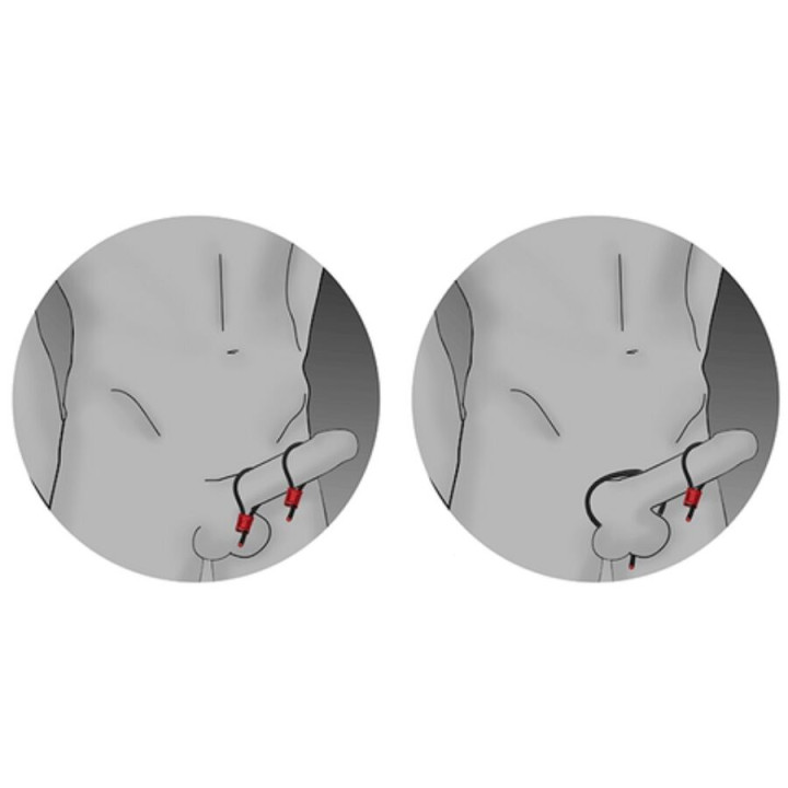 ELECTRASTIM PRESTIGE ELECTRA LOOPS ANILLOS DE PENE AJUSTABLES ROJO