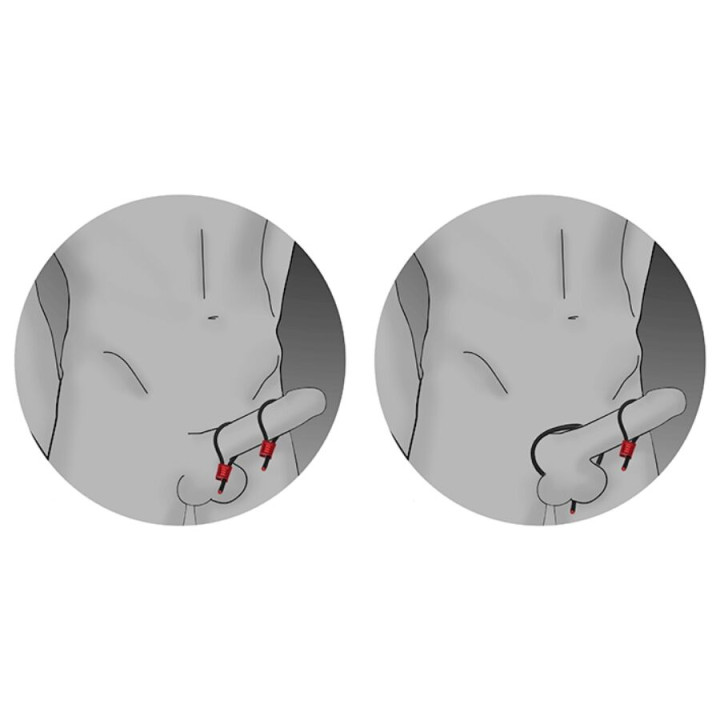 ELECTRASTIM PRESTIGE ELECTRA LOOPS ANILLOS DE PENE AJUSTABLES NEGRO